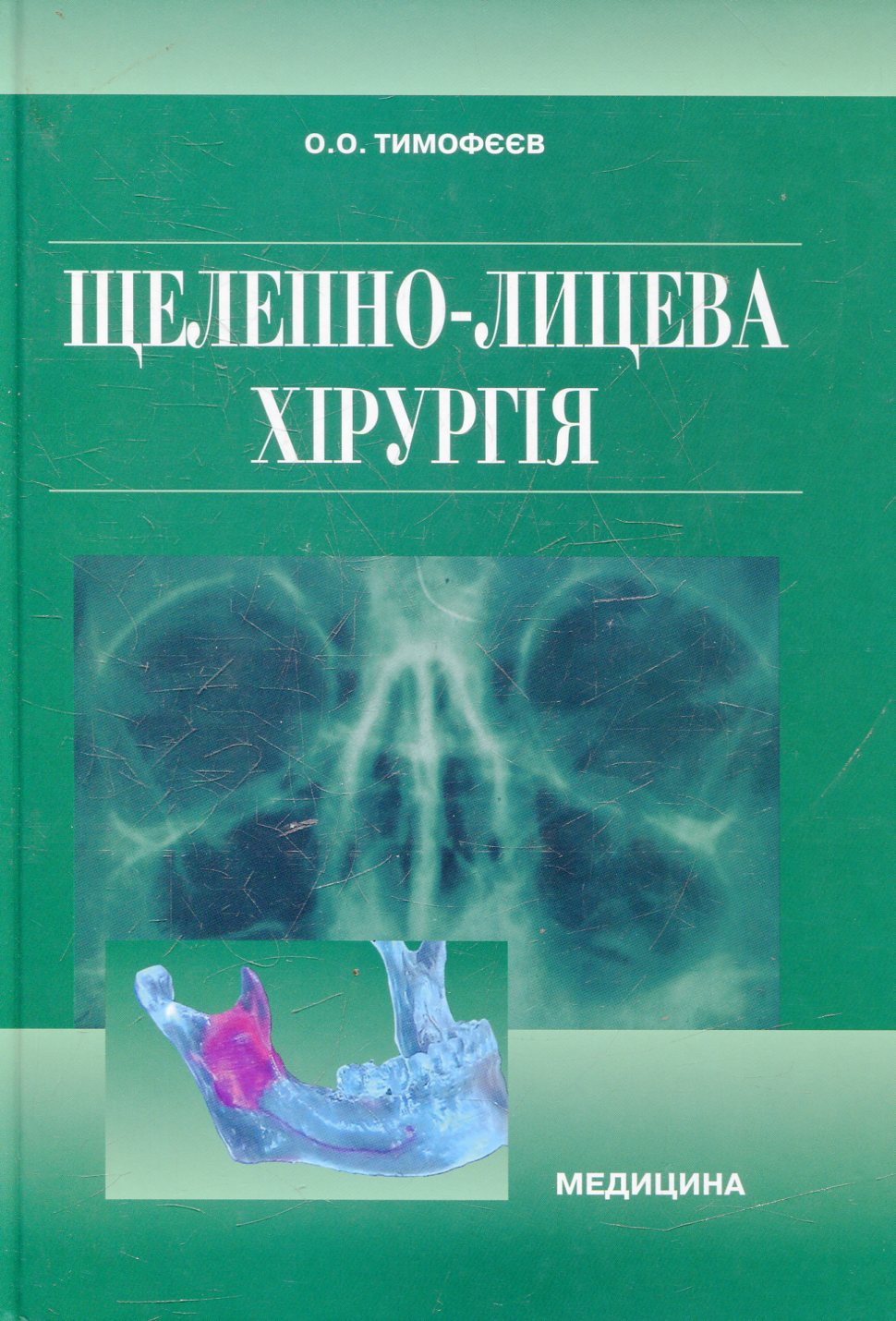 Щелепно-лицева хірургія