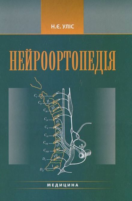 Нейроортопедія