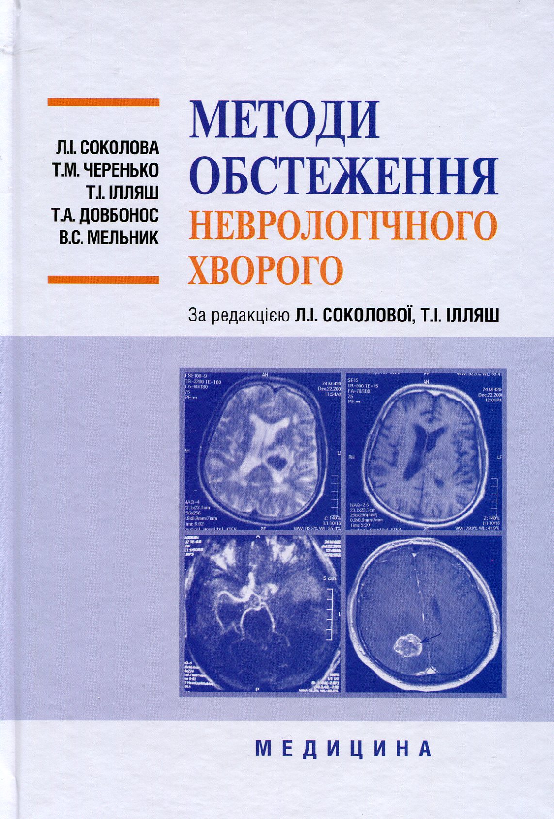 Методи обстеження неврологічного хворого. Навчальний посібник для мед. ВНЗ ІІІ-ІV р.а. 