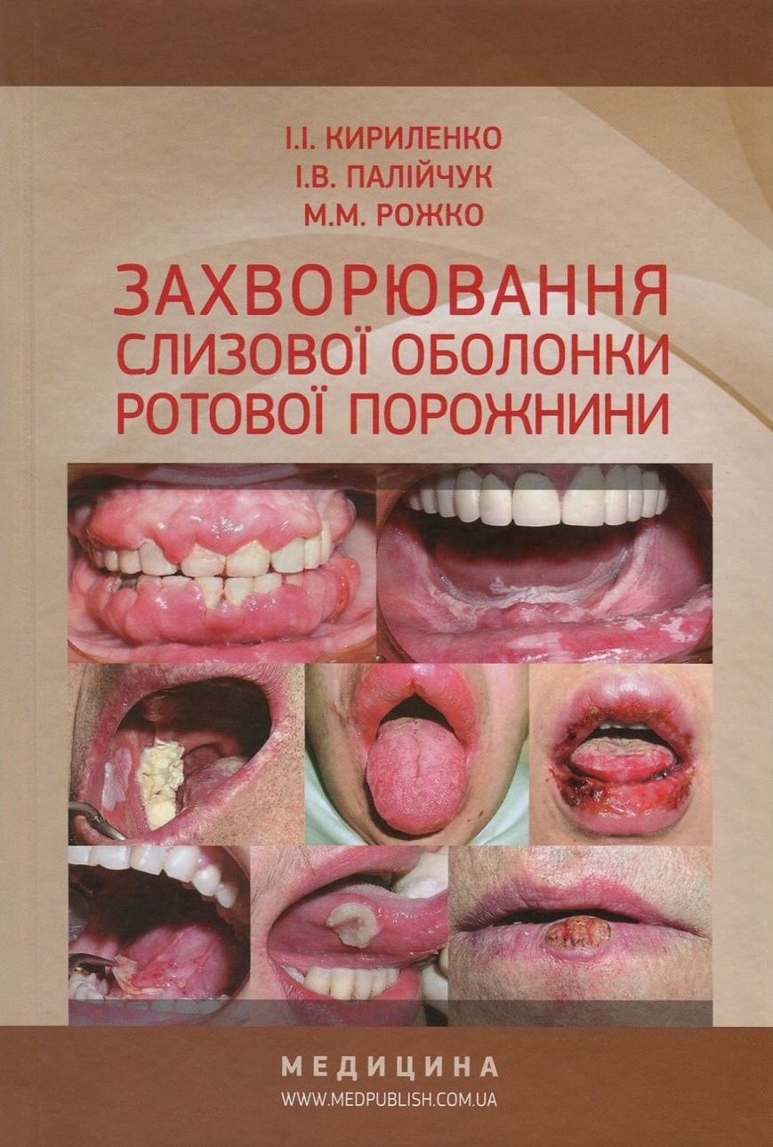 Захворювання слизової оболонки ротової порожнини