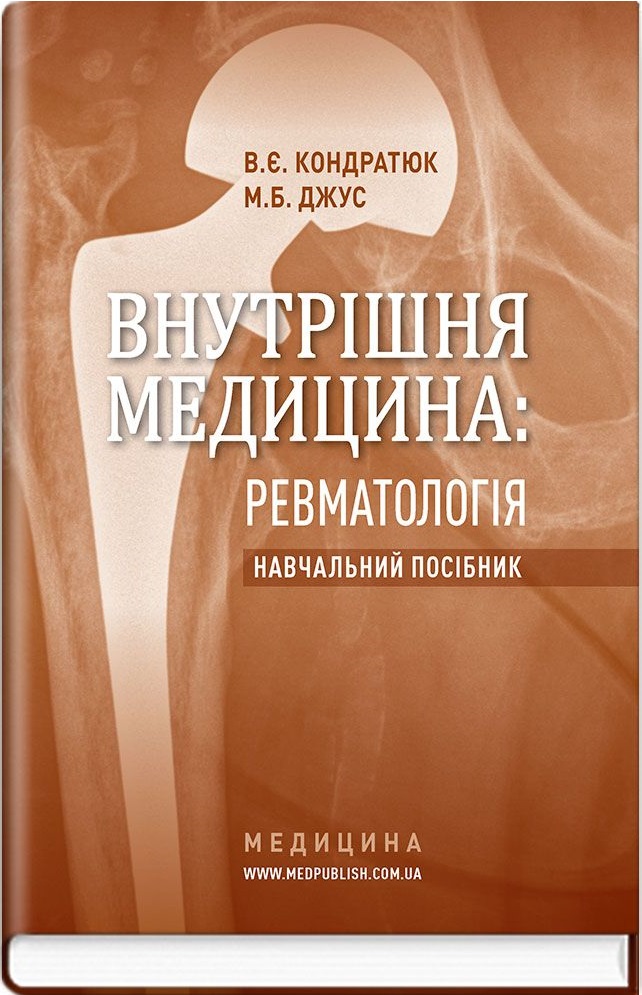 Внутрішня медицина: Ревматологія