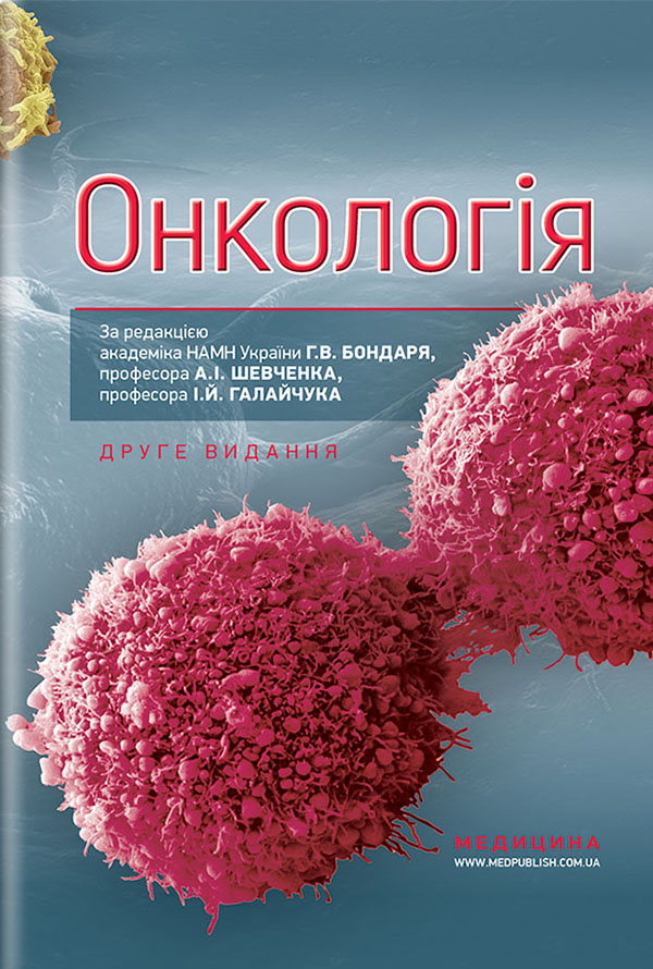 Онкологія. Підручник