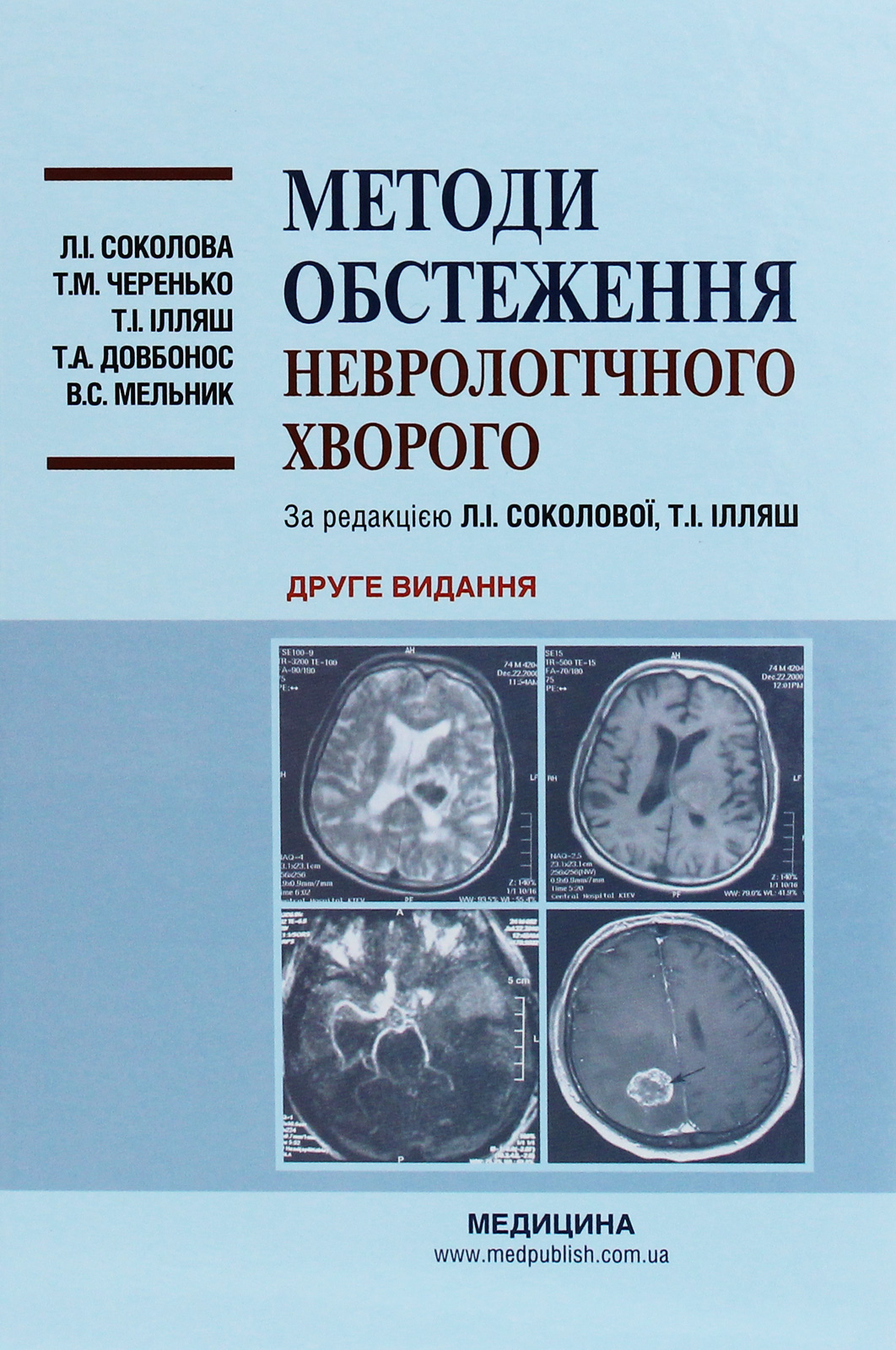 Методи обстеження неврологічного хворого