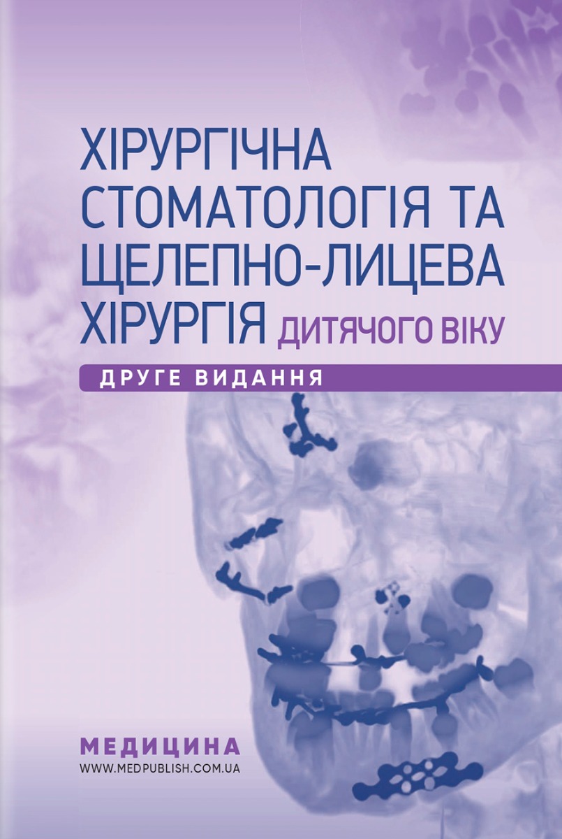 Хірургічна стоматологія та щелепно-лицева хірургія дитячого віку