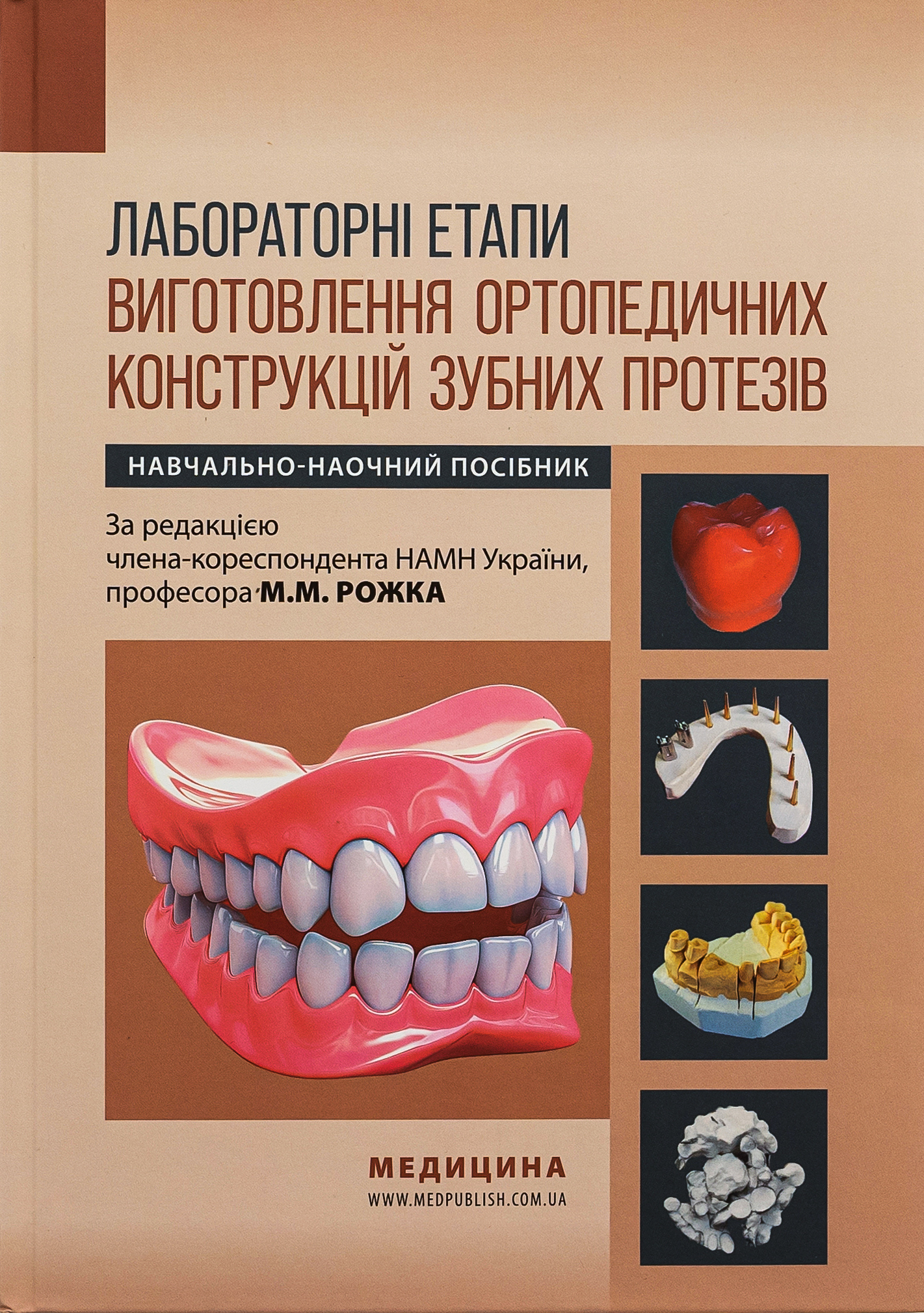 Лабораторні етапи виготовлення ортопедичних конструкцій зубних протезів
