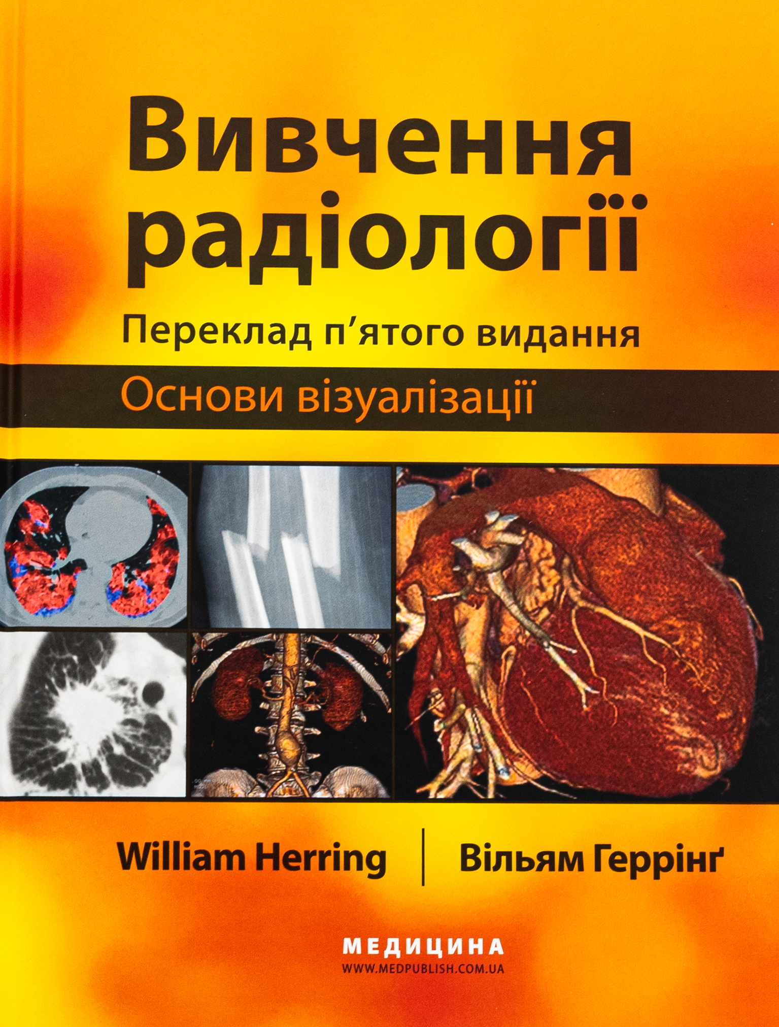 Вивчення радіології. Основи візуалізації