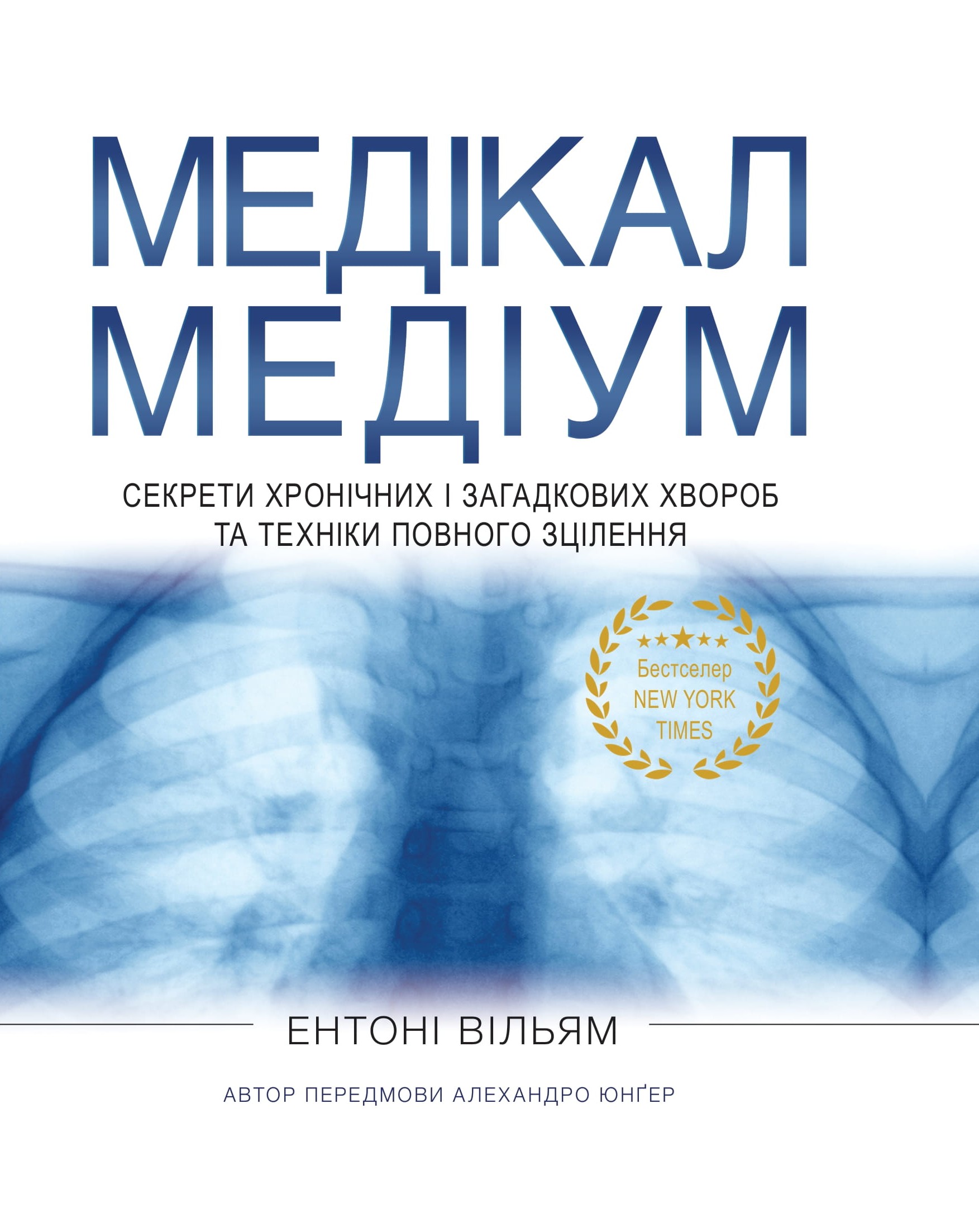 Медікал Медіум. Секрети хронічних і загадкових хвороб та техніки повного зцілення