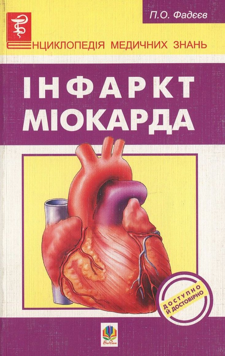 Інфаркт Міокарда