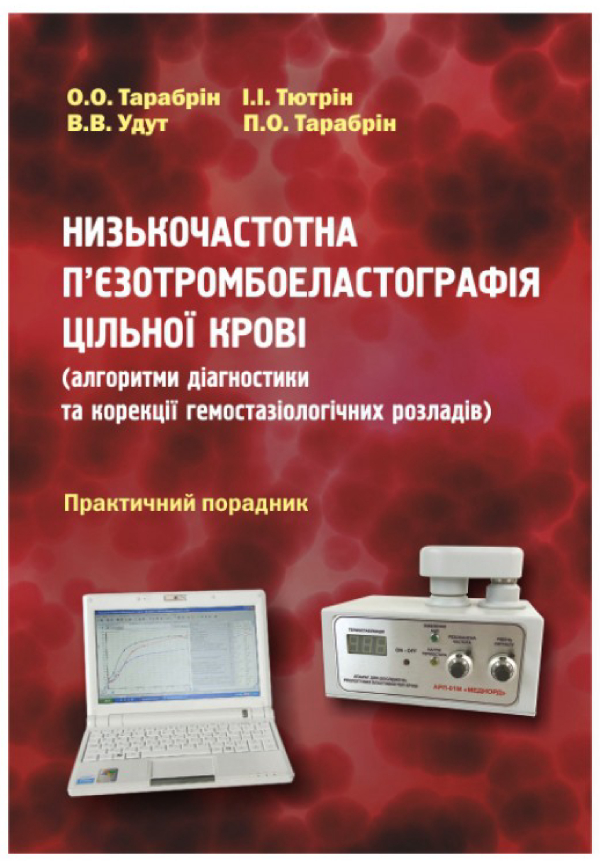 Низькочастотна п`єзотромбоеластографія цільної крові (алгоритми діагностики та корекції гемостазіологічних розладів)