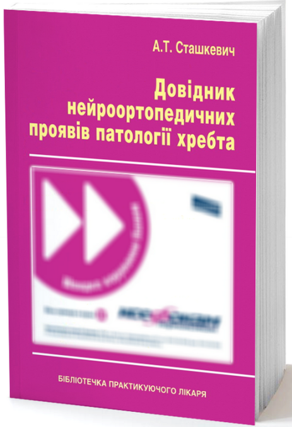 Довідник нейроортопедичних проявів патології хребта